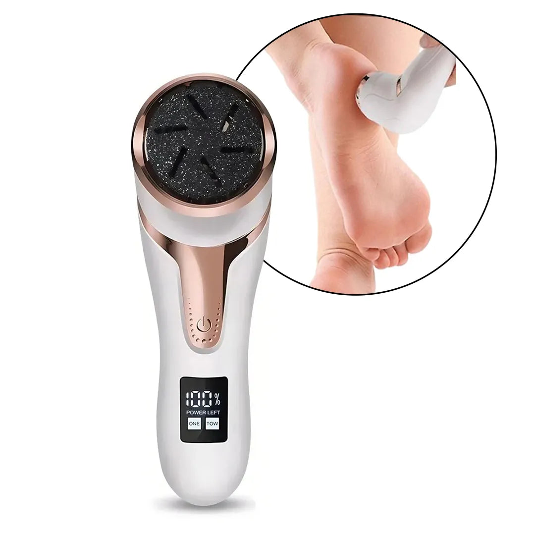 Removedor de Callos y Exfoliador de Pies Calidad Superior – Mil Ideas