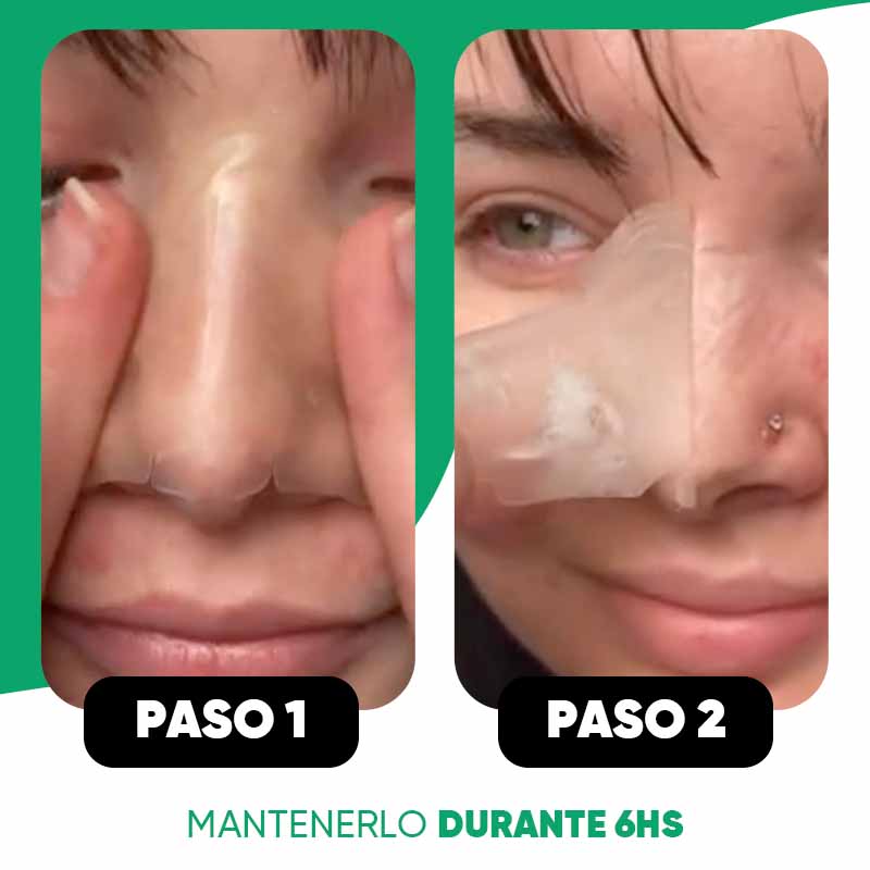 Pack 10 parches anti-acné para nariz Luminex vista adicional – Mil Ideas