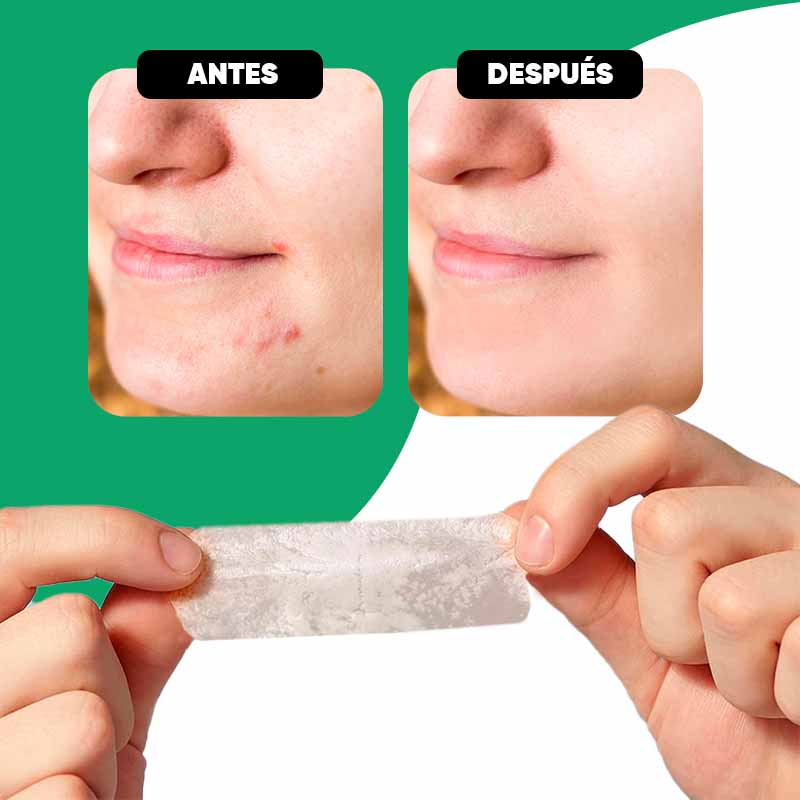 Pack de 10 Parches Anti-Acné Rectangulares Luminex vista adicional – Mil Ideas