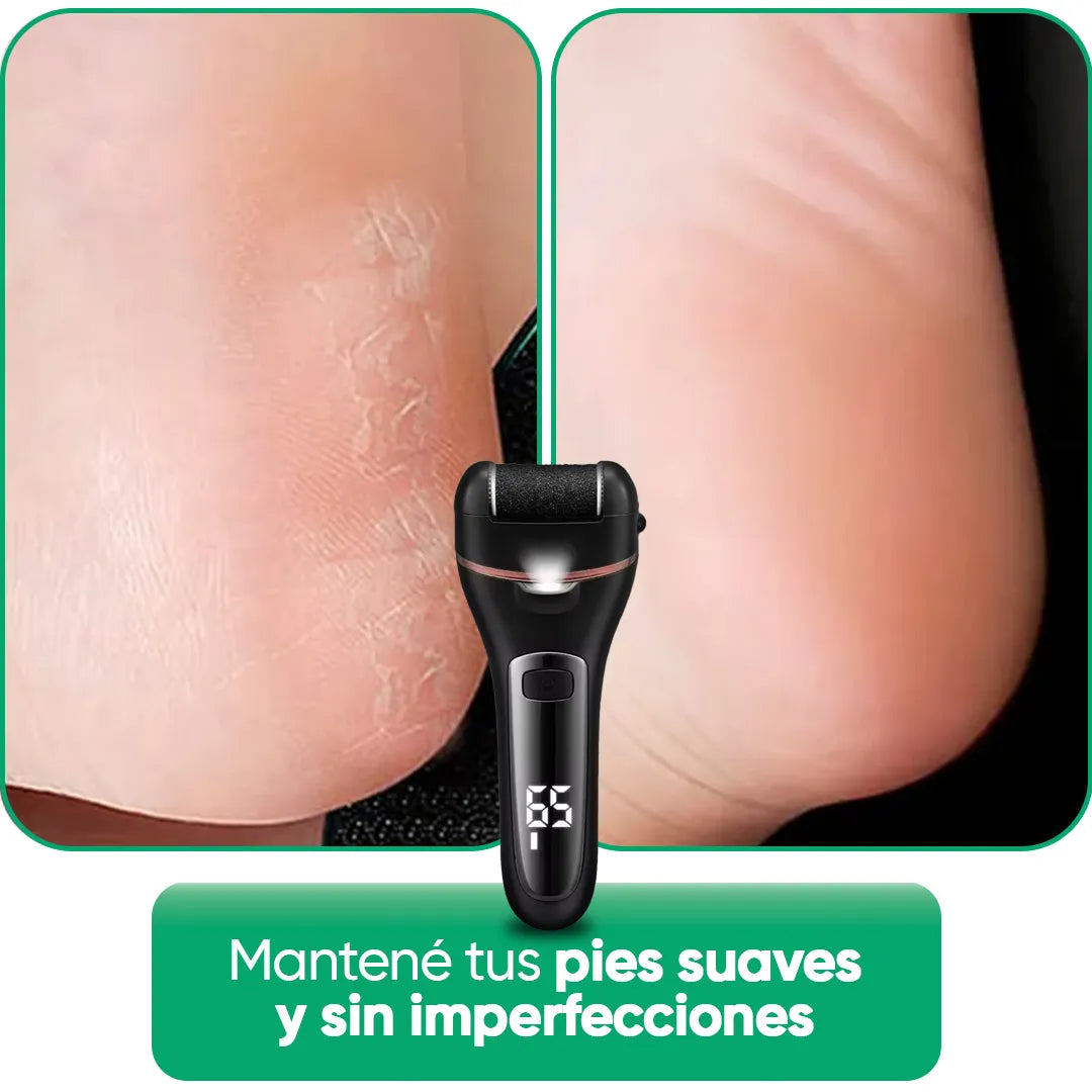 Removedor de callos en uso sobre pie en uso – Mil Ideas