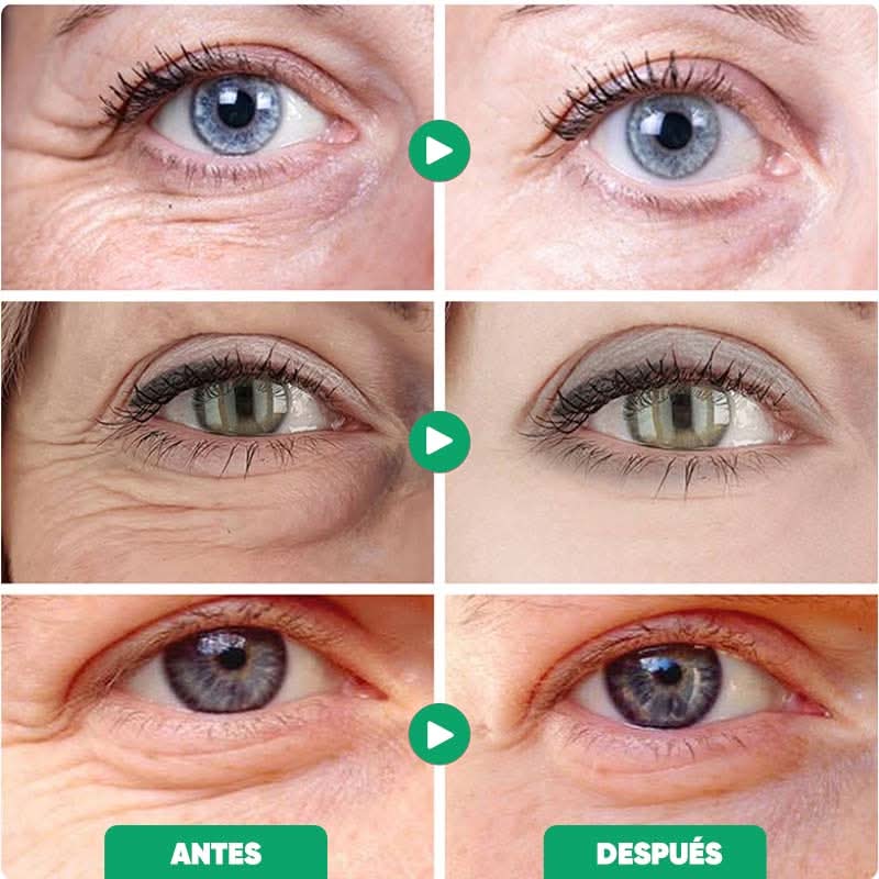 Crema Antiarrugas de Retinol para Ojos vista adicional – Mil Ideas