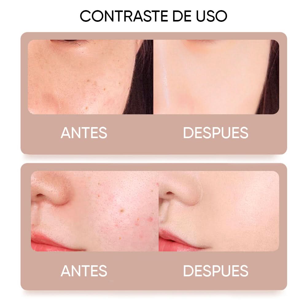 Lápiz cauterizador de plasma detalle – Mil Ideas