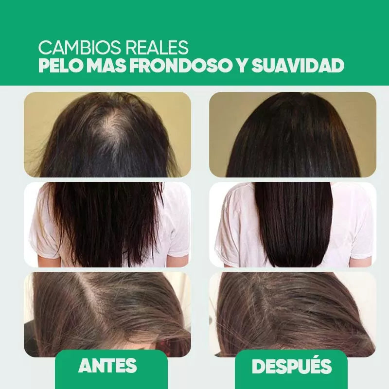 Aceite Natural Eelhoe para el Crecimiento del Cabello en uso – Mil Ideas