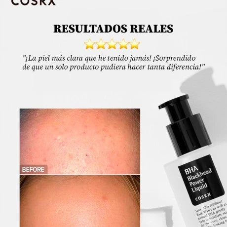 BHA Blackhead Power Liquid COSRX exfoliante químico vista adicional – Mil Ideas