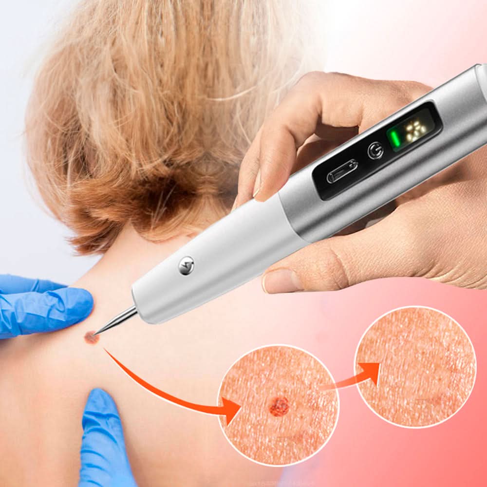 Lápiz cauterizador de plasma vista adicional – Mil Ideas