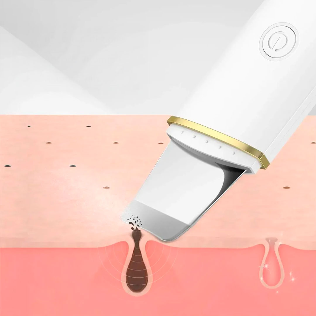 Espátula facial ultrasónica limpieza profunda portátil vista adicional – Mil Ideas